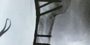 <?php the_title(); ?>